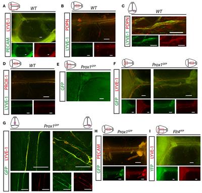 Lymph Flow Induces the Postnatal Formation of Mature and Functional Meningeal Lymphatic Vessels